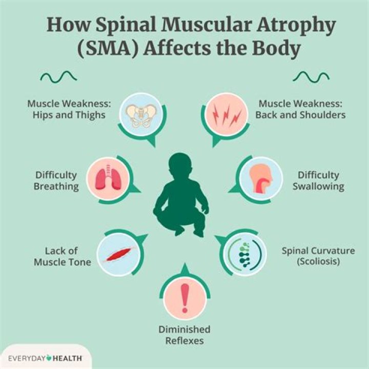 Are atrophy and dystrophy the same thing?