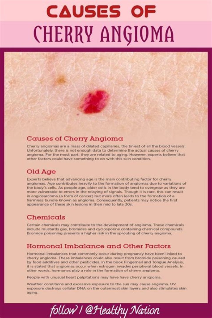 Are cherry hemangiomas dangerous?