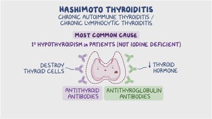 Are hypothyroidism and hashimoto's the same?
