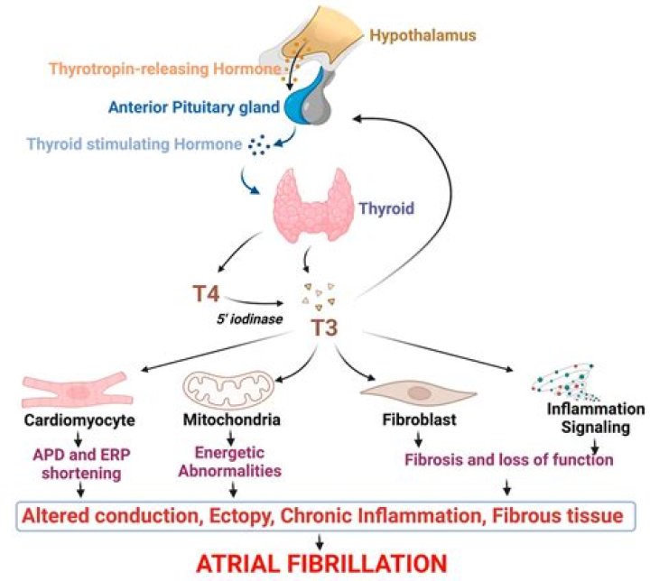 Are hypothyroidism and hypogonadism related?