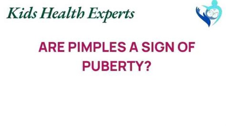 Are pimples a sign of puberty?