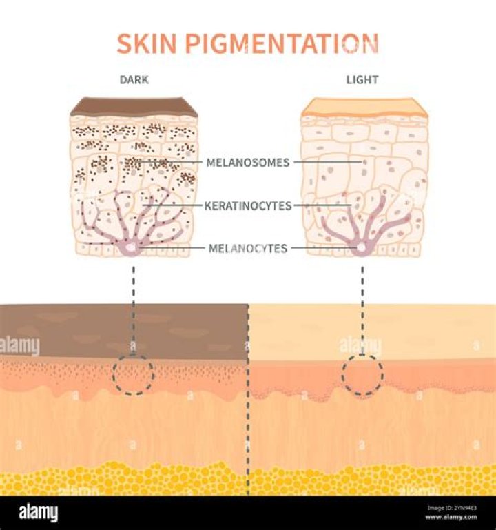 Are skin pigmentation cells found in the dermis?