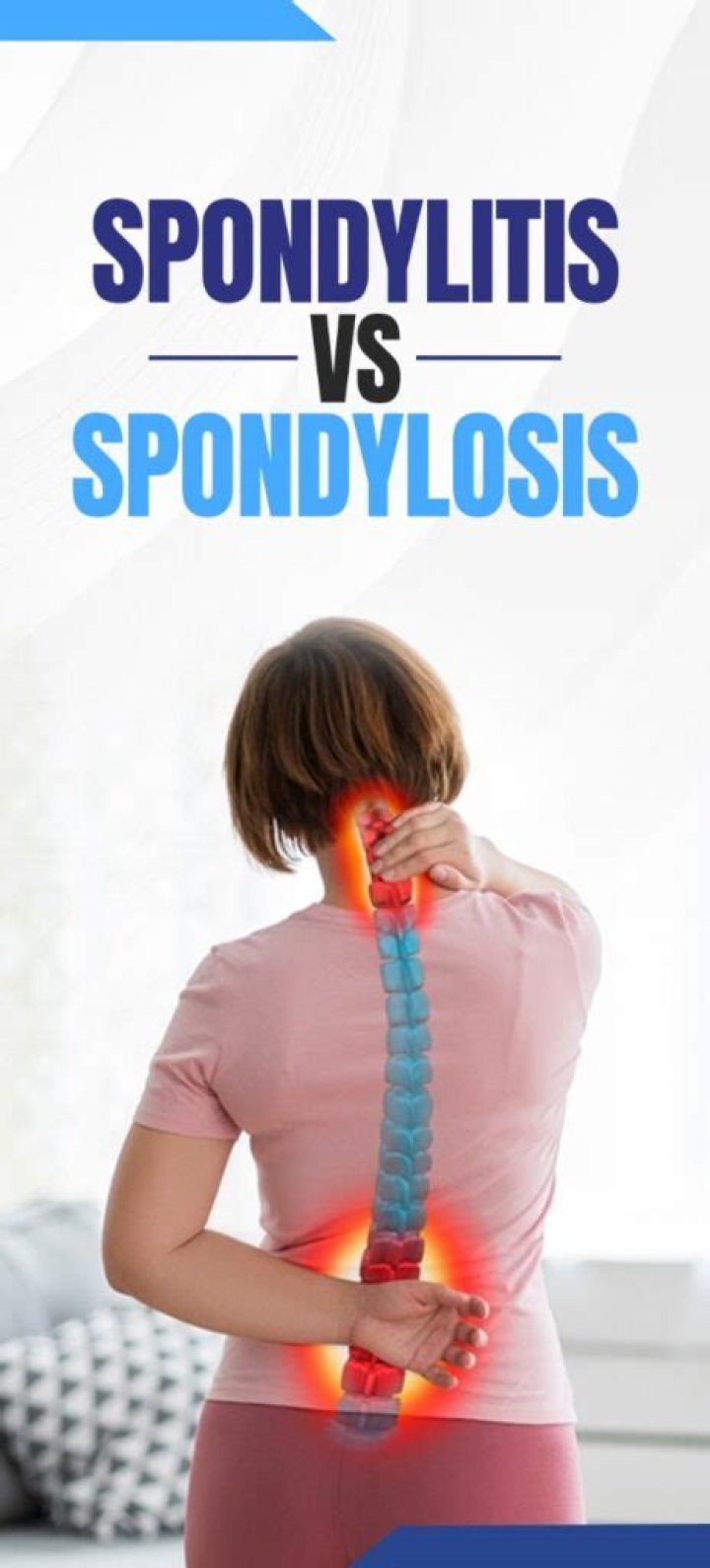 Are spondylosis and spondylitis the same thing?