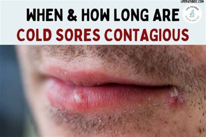 Are unbroken cold sores contagious?