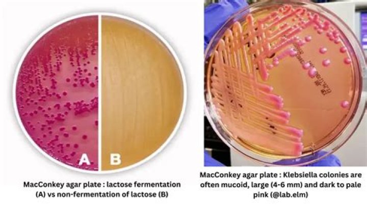 Can aerogenes ferment glucose?