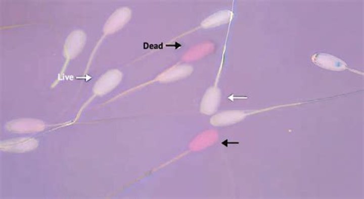 Can dead sperm come alive?