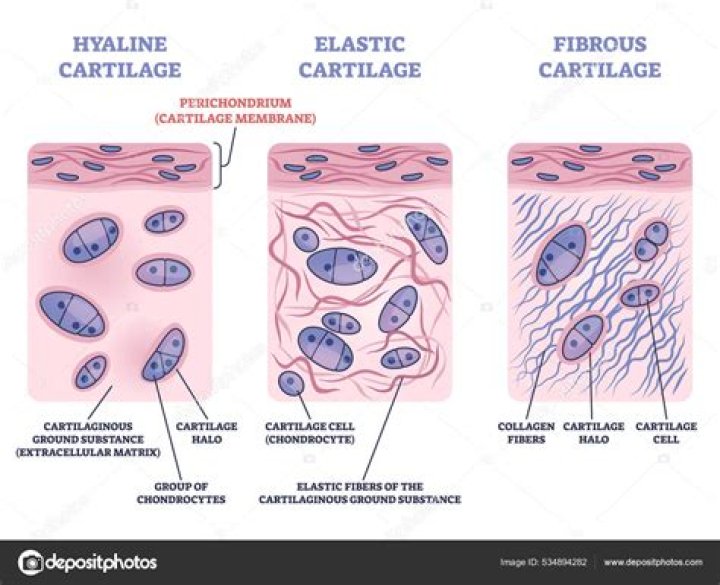Can fibrocartilage replace hyaline cartilage?