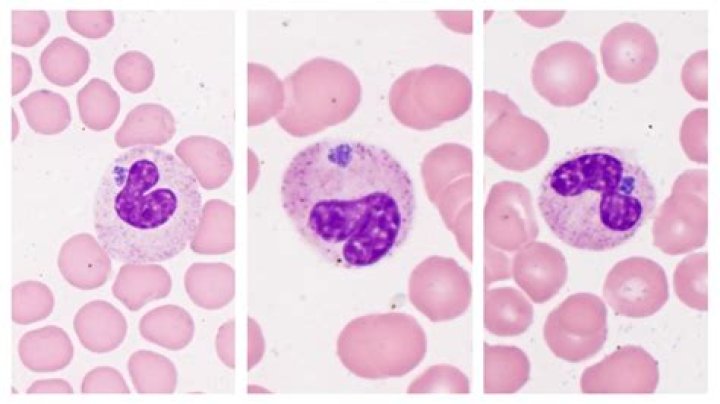 Can humans get anaplasmosis?