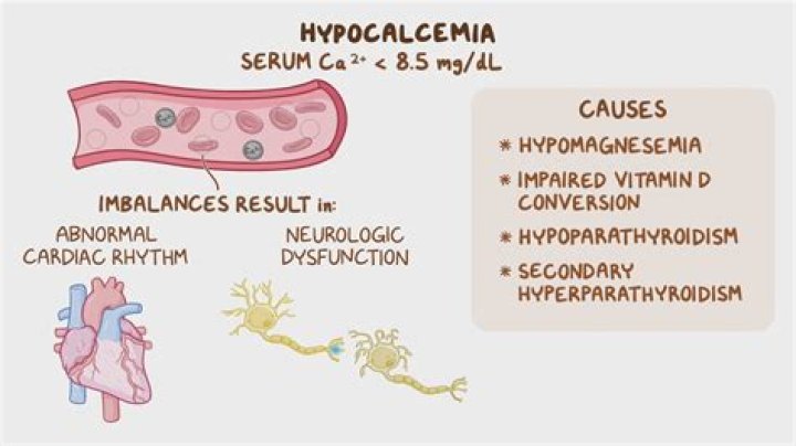 Can hypocalcemia cause arrhythmia?