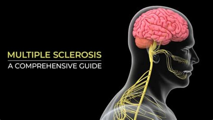 Can multiple sclerosis cause poliomyelitis?