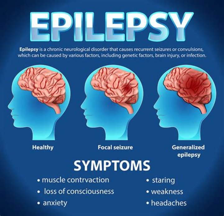 Could epilepsy kill you?