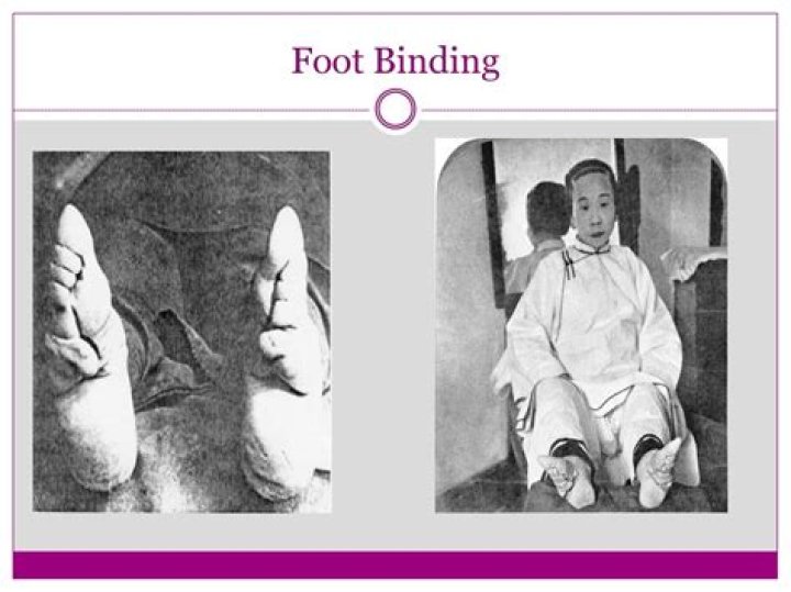 Did foot binding hurt?