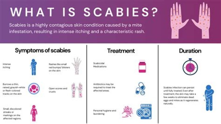 Did scabies treatment work?