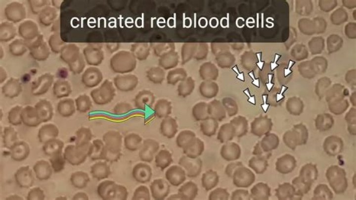 Do blood cells crenate?