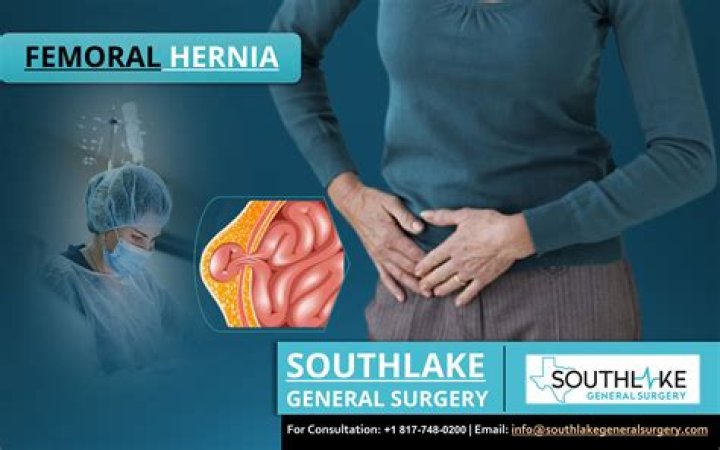Do femoral hernias hurt?