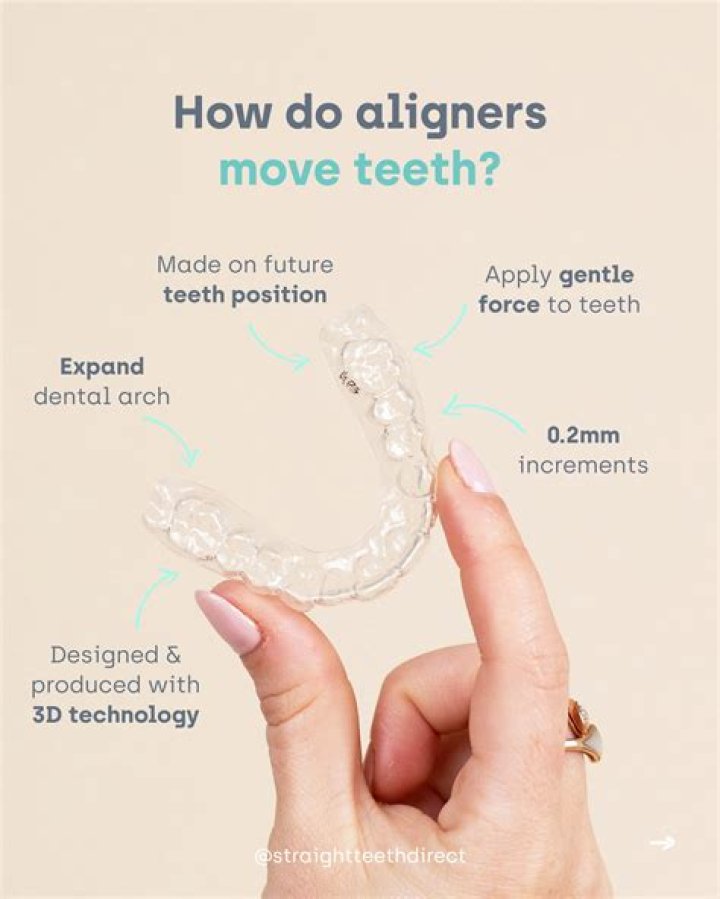 Do overcorrection aligners move teeth?