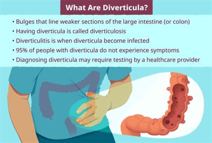Do you lose weight with diverticulitis?