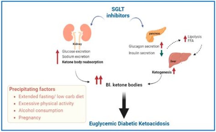 Does all weight loss involve ketosis?