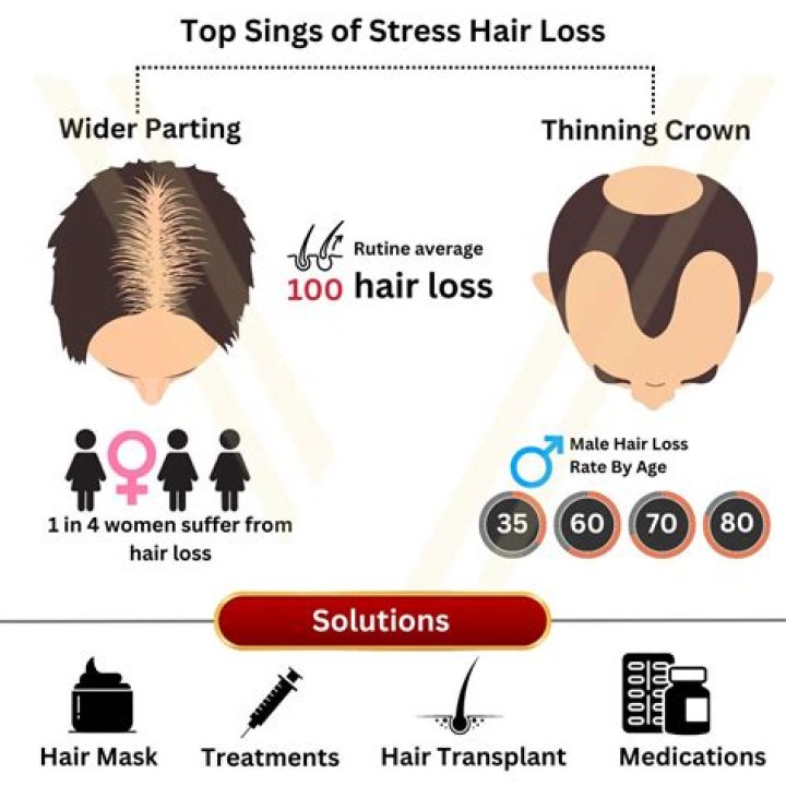 Does epistane cause hair loss?