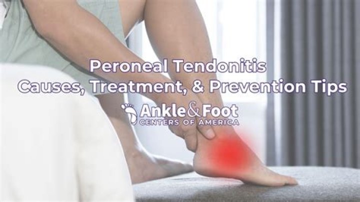 Does pronation cause peroneal tendonitis?