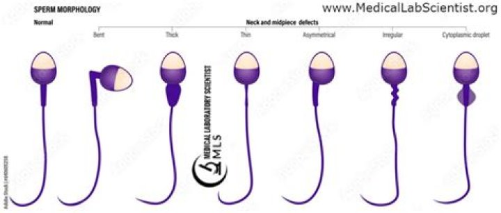 Does sperm morphology matter?