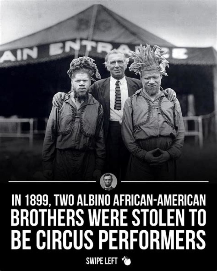 George And Willie Muse, The Black Brothers Kidnapped By The Circus