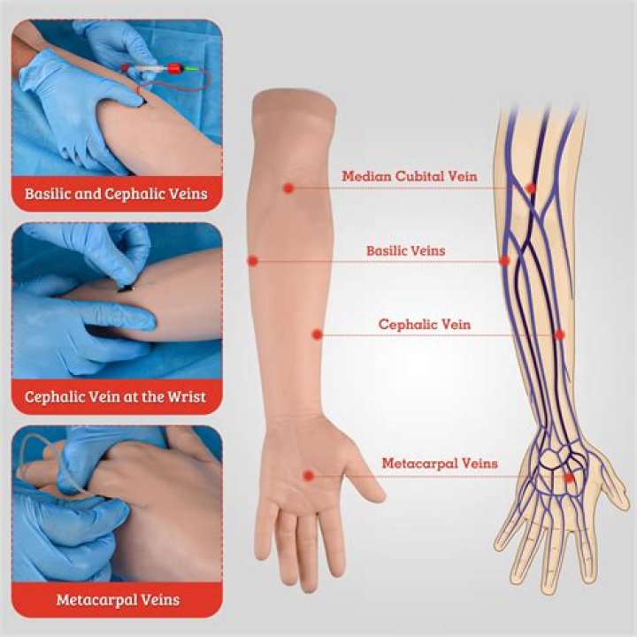 How do vesicant work?