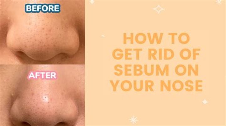 How to get rid of sebum?