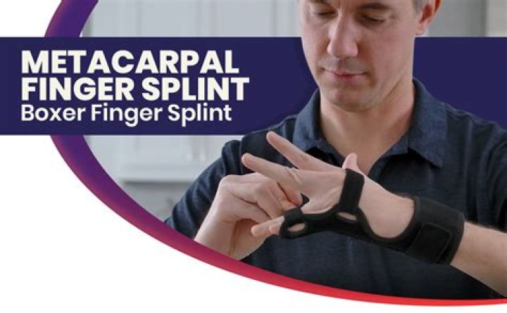How to splint broken metacarpal?