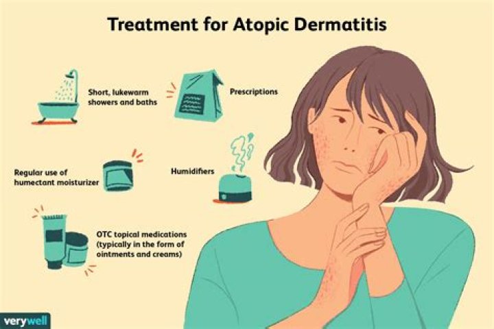 Is atopic dermatitis an autoimmune disease?