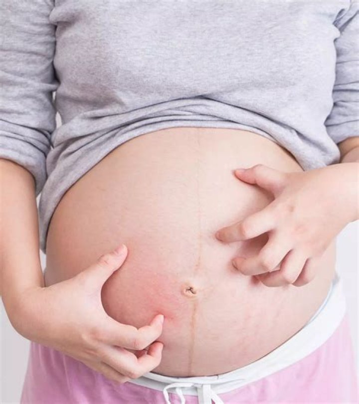 Is belly sore during pregnancy?