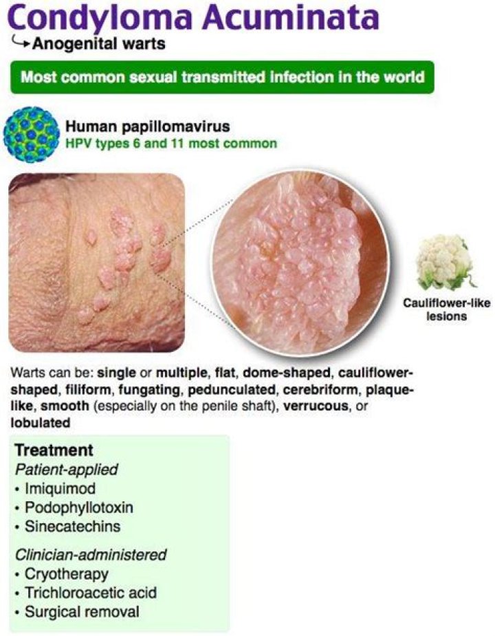 Is condyloma acuminatum contagious?