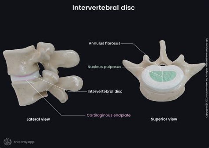 Is hyaline cartilage found in intervertebral discs?