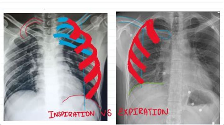 Is it inspirator or inspirer?