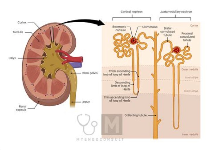 Is suppuration of the kidney?