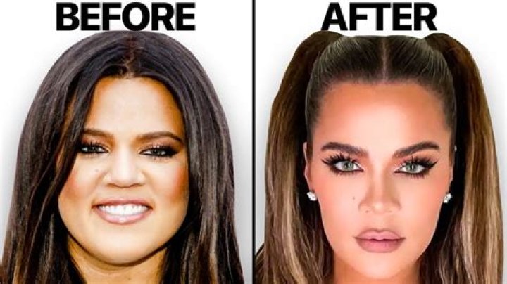 Khloe Kardashian Is an Open Book About Plastic Surgery: See Photos of Her Transformation