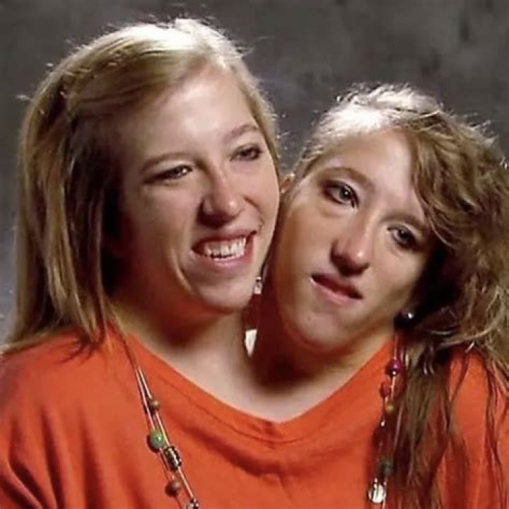We Finally (Sorta) Have Answers About the Sex Lives of Conjoined Twins, Abby and Brittany