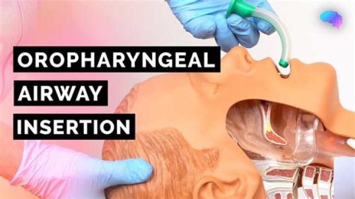 What is an oropharyngeal?