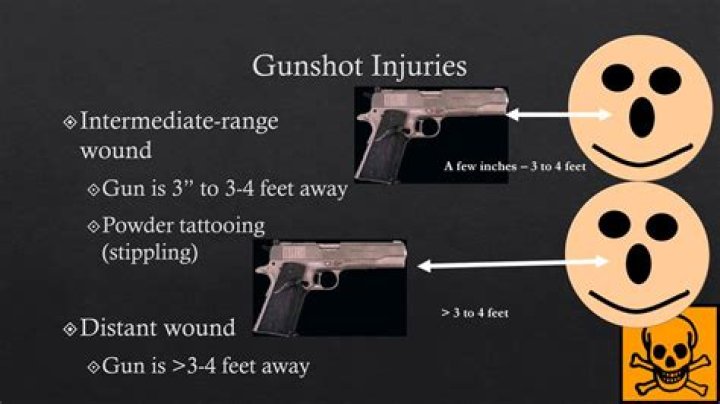 What is gunshot stippling?