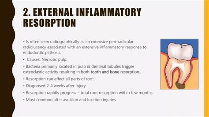 What is inflammatory root resorption?