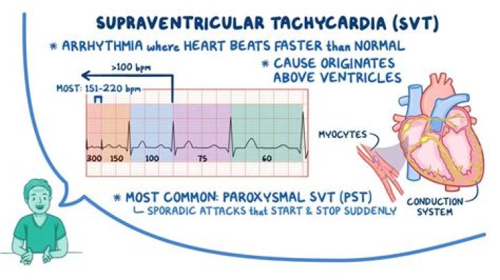 What is supraventricular extrasystoles?