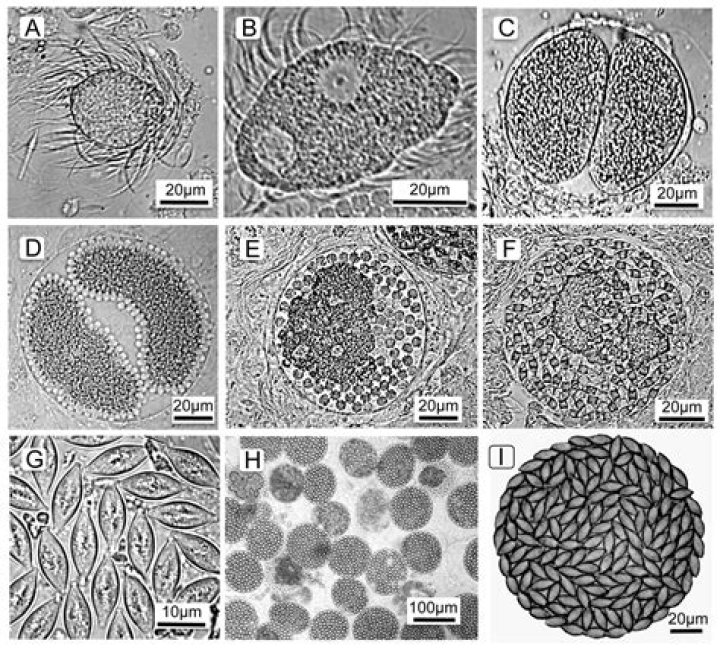 What is the meaning of a monocystis?