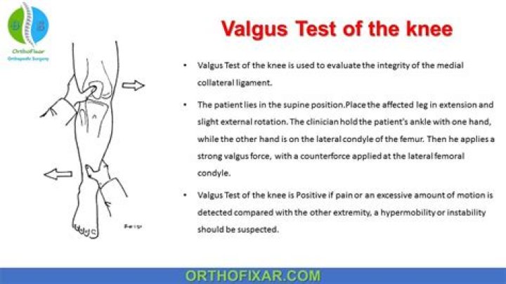 What is valgus stress test?
