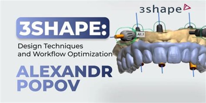 Whats a bonded retainer?