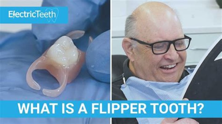 Whats a flipper tooth?