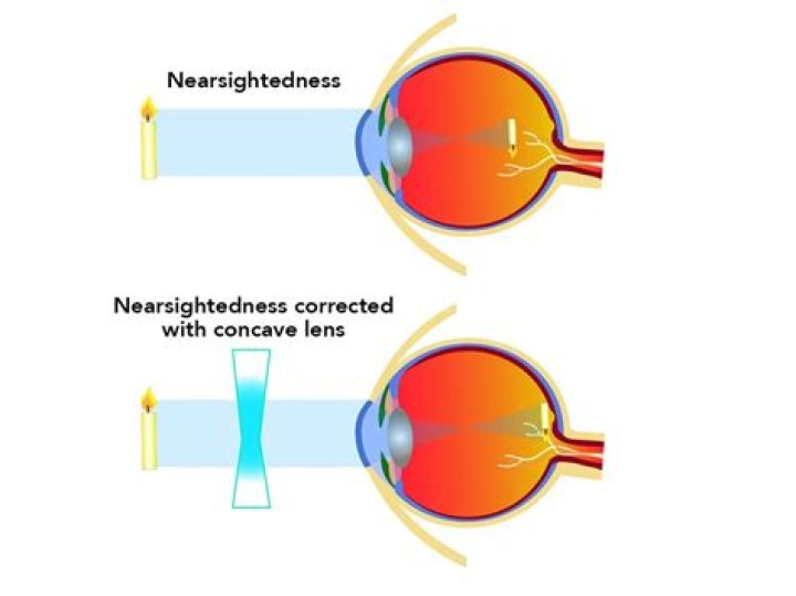 Whats the opposite of nearsighted?