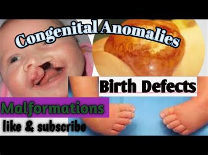 When do congenital malformations occur?