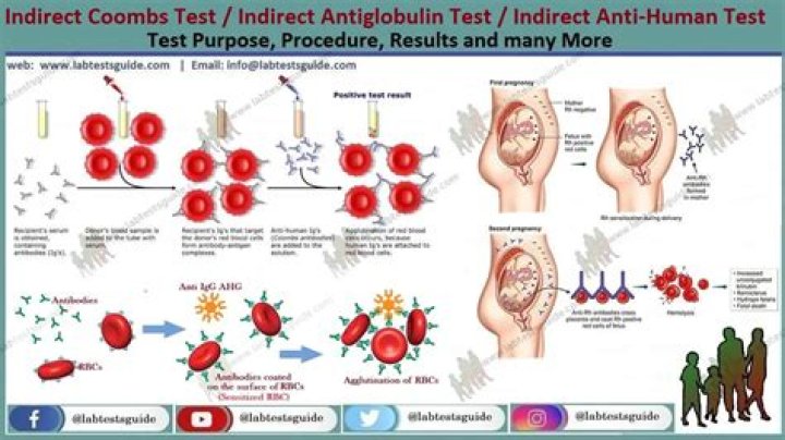 When is indirect coombs test done?