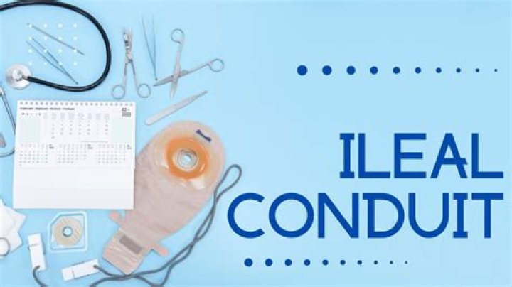 When to empty ileal conduit?