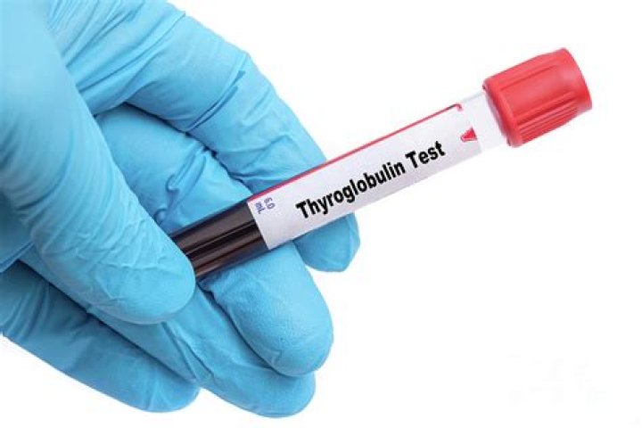 When to take thyroglobulin test?